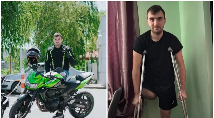 Tânărul motociclist, care a rămas fără un picior în accidentul de la Pașcani, are nevoie de ajutor pentru o proteză